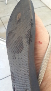 BLOODY SHOE: My flip-flop just after stepping into a "puddle" of blood in Yeoville - Yuck! Photo: Ilanit Chernick